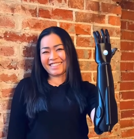 Nora with new arm