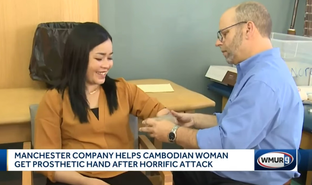 Nora fitted for prosthetic arm